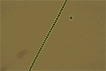2-MIBを産生するPseudanabaena sp.の顕微鏡写真