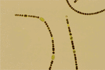 ジェオスミンを産生するDolichospermum sp.の顕微鏡写真