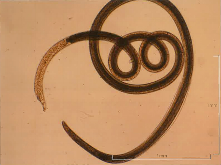 ホタルイカから取り出した旋尾線虫幼虫の写真