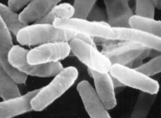 レジオネラ菌の写真