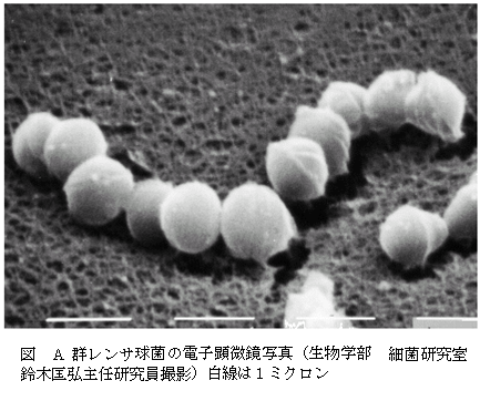 A群レンサ球菌の電子顕微鏡写真