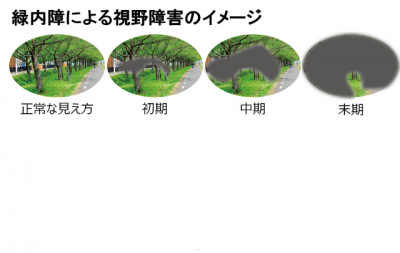 長寿科学振興財団