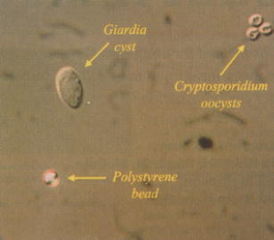 クリプトスポリジウムの顕微鏡写真